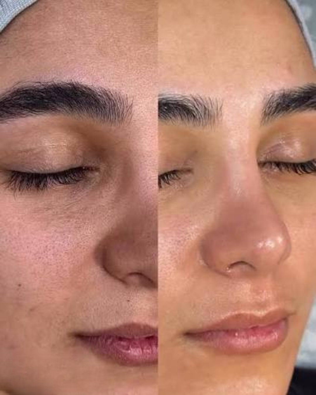 İlk kullanımda bile cildim çok daha canlı görünüyordu